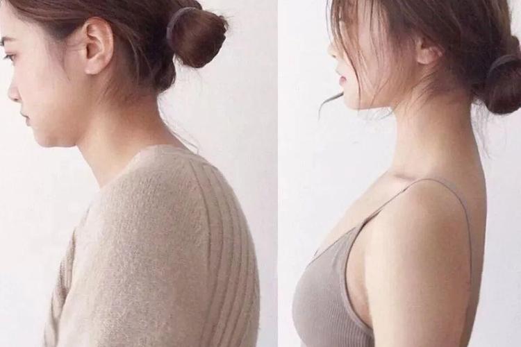 分享:脖子前倾可以这样睡觉缓解啦!