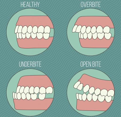 上,下颌骨大小比例不相称 人的牙齿咬合结构包含上颌骨和下颌骨