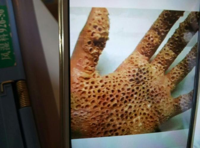 嫌不够重口味的,没有密集恐惧症的 自己百度莲蓬乳,别怪我没有提醒你.