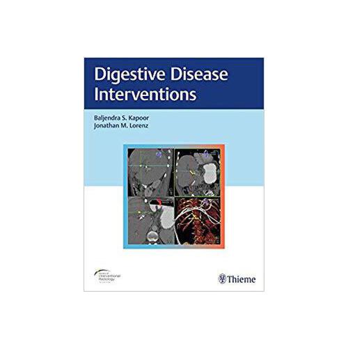 digestive,intestines 【预订】digestive disease interventions 9781626233744
