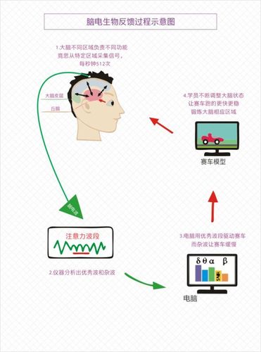脑电生物反馈训练