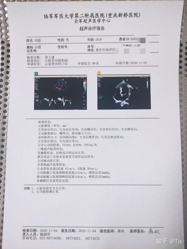 不知道平台用户有没有心内科或者心电图检查的从业者?