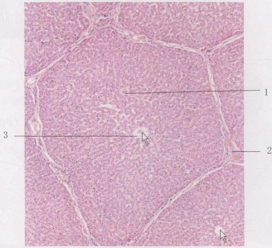 图4-43 肝小叶