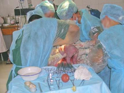 血腥惊恐剖腹产现场实拍