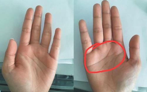 多条感情线的手相,对感情婚姻有多少影响