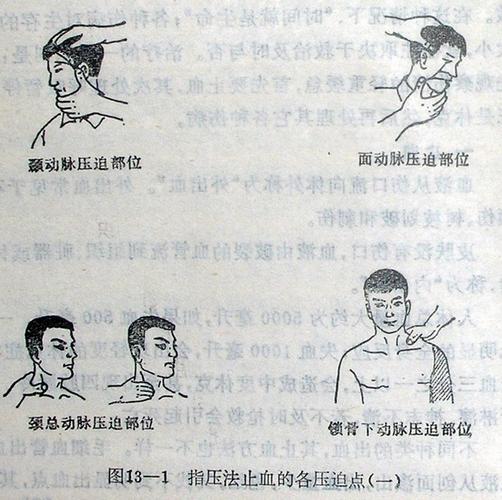 止血时只需要干净的餐巾纸,手帕,布片或纱布扎紧就行了.