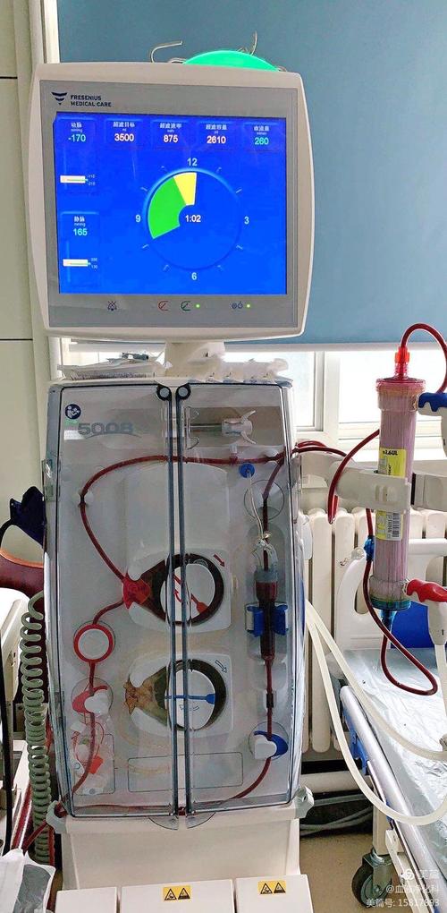聊城市三院血液净化科费森尤斯5008s智能血液透析滤过
