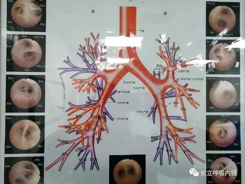 42个支气管亚段,如何实现精准定位?| 右下叶背段篇
