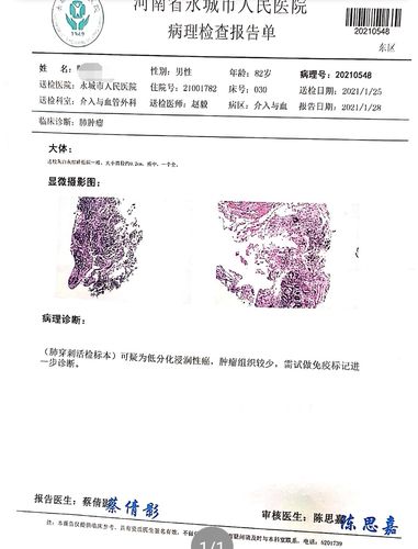 【穿刺活检术】肺结节穿刺活检术,临床意义非凡