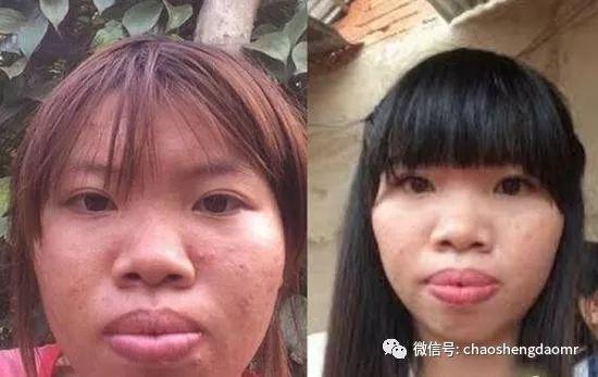 越南凤姐整容后竟然美到嫁给富二代