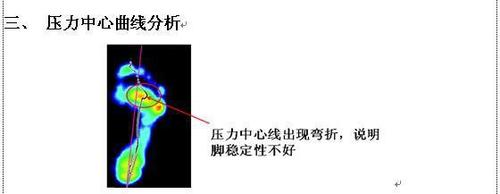 足底压力测试对于足踝疾病诊断和治疗的意义