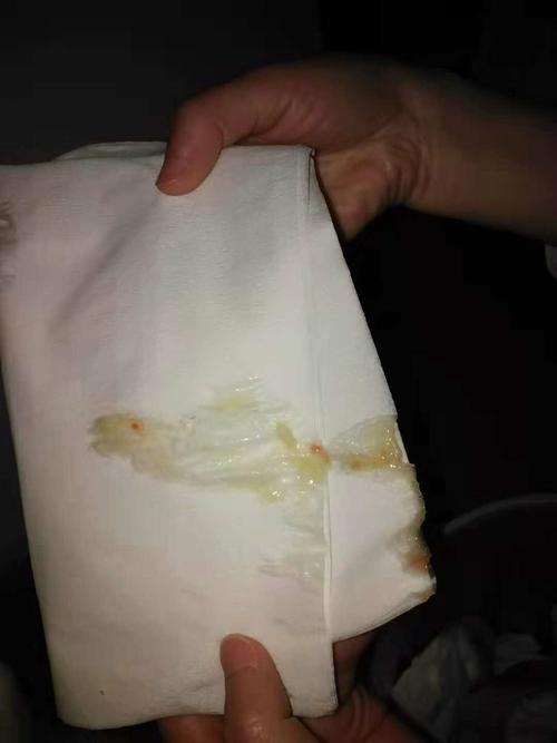 萨摩呕吐带血,(有图,恶心者甚入)