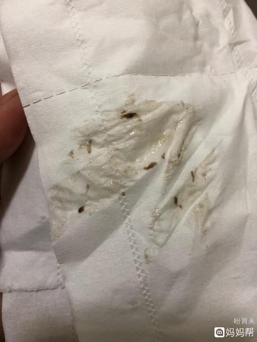 子宫内膜炎,月经干净后老是有分泌物