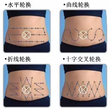 一图秒懂丨胰岛素腹部轮换注射的4种轨迹