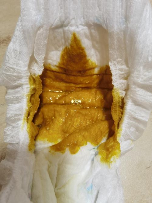 纯母乳宝宝这样的大便稀不(有屎图慎入)_母乳_母婴