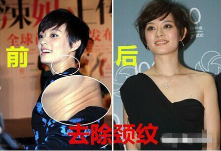 孙俪自曝曾是丑女 坦言"整过容"!
