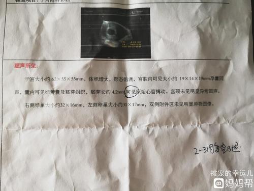 6周2这个胎囊形状生男孩女孩呢