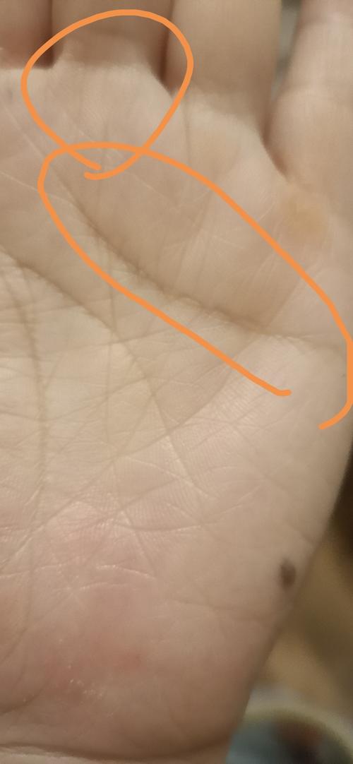 我们再来看一下这一张手图到底 如何区分锁链纹与岛纹呢,那这一张手图