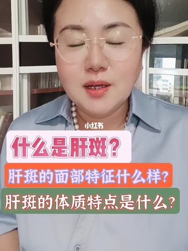 肝斑的所有特点,请看这里.