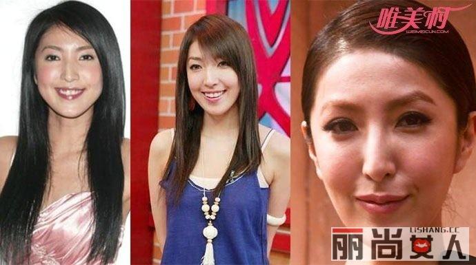 杨谨华整容失败 靠三级成名的她如今竟变成这样忒吓人