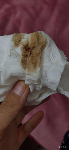 今天出现褐色分泌物,吓死宝宝了,幸亏去医院检