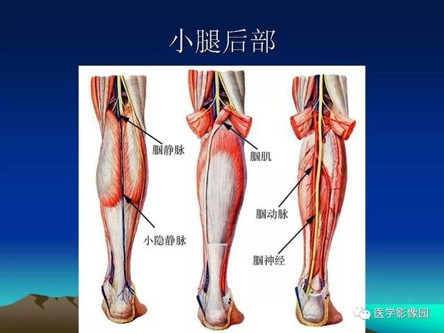 腘动脉陷迫综合征影像学诊断 | 影像天地