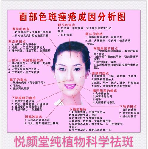 如何识别色斑及不同斑如何搭配产品