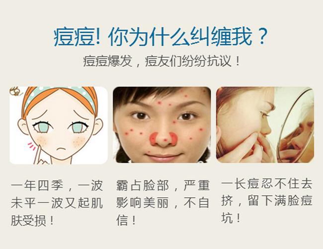 西安画美医疗美容医院——什么是微针祛痘?