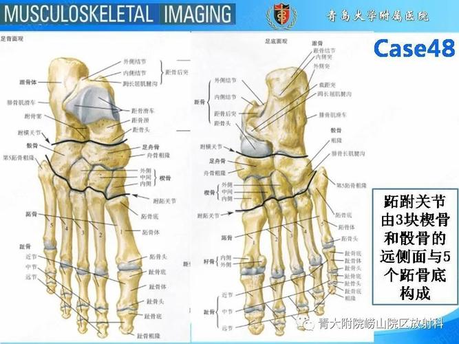 一文掌握跖跗关节骨折脱位