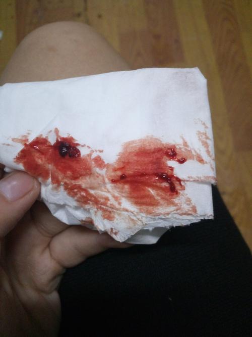 月经期前一天做爱,月经延迟三天没来我每次月经都会提