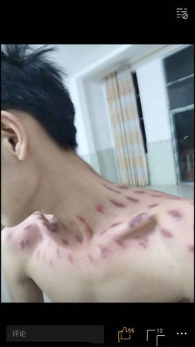 我把草莓还你脖子上吧