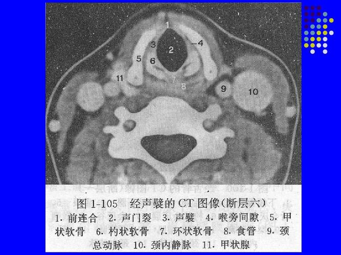 颈部淋巴结分区 ct影像学 人体断面解剖学 影像诊断 胸部断层解剖