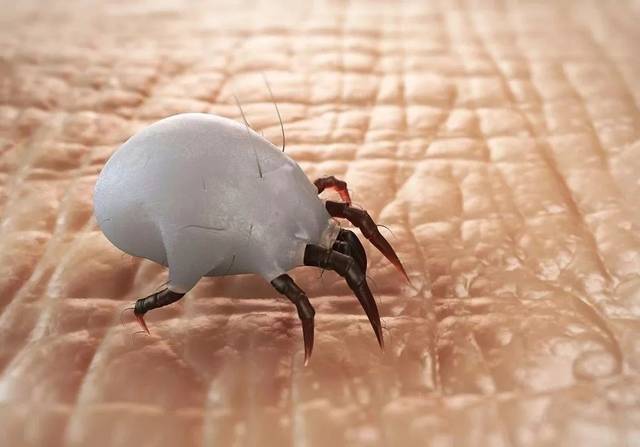 判断脸上有螨虫的四种症状,你都知道吗?