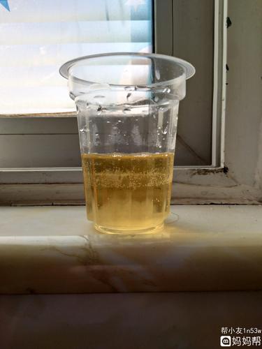 酒精测男女,看看是男孩还是女孩?