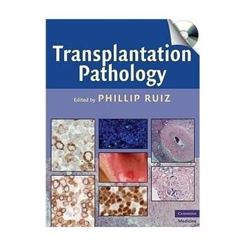 transplantation pathology (cambridge medicine)(book cd-rom)