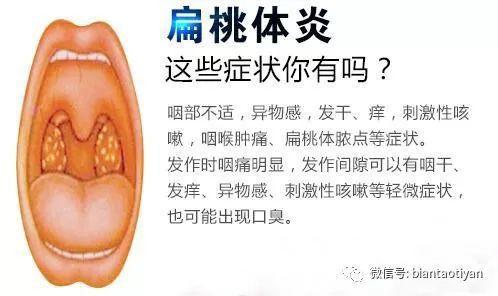 咽喉炎与扁桃体炎有什么区别