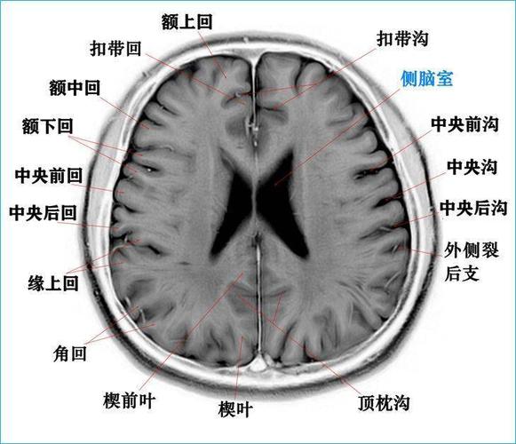 这个高清颅脑断层解剖图谱实在太棒了!【磁共振 大体标本】