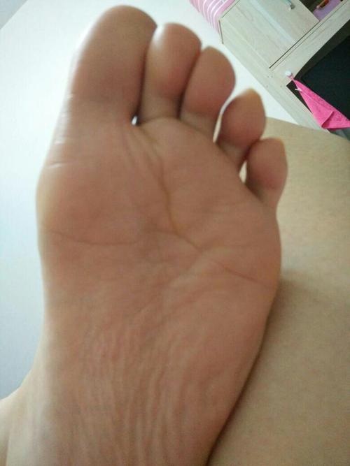 谁知道这是脚底人字纹吗,是不是很好呢?