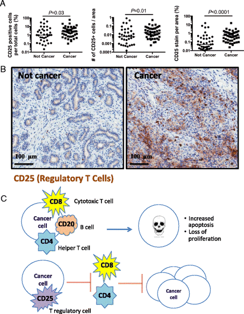 increased infiltration of regulatory t cells in kenyan breast