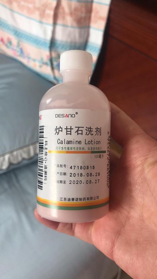 只能擦点炉甘石洗剂!痒得