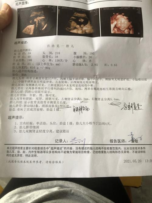 四维检查肾盂分离是什么意思,_胎儿_四维彩超_胎盘_母婴_孕产经验