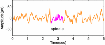 sleep spindles are characteristic electroencephalogram (eeg)