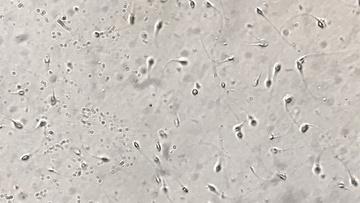 卵巢_切片_显微镜_全景视频