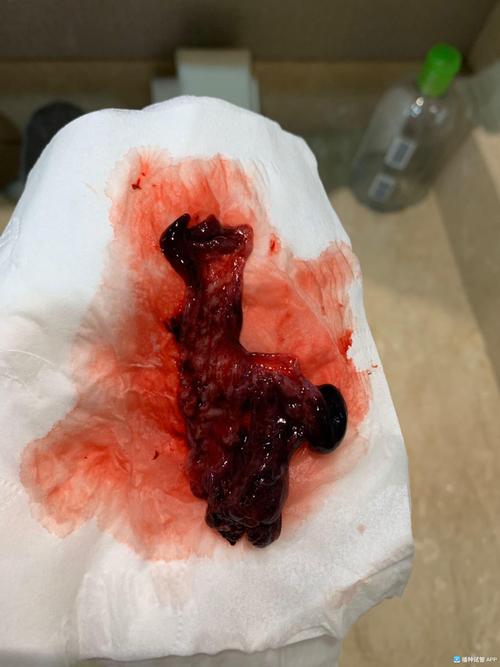 [试管婴儿]这是我今天吃药流出来的,开了3