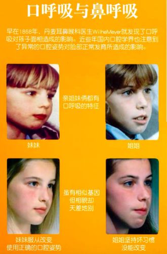 口呼吸的危害和矫正-78之前分享