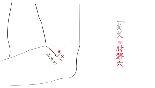 一刻艾对症下灸丨网球肘的艾灸疗法