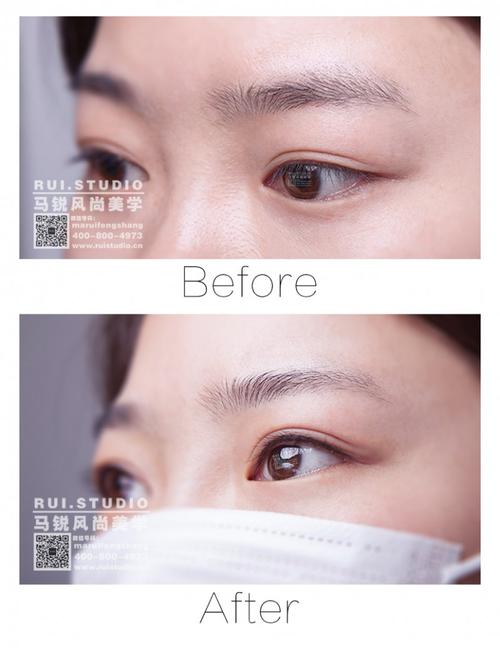 北京半永久美睫线韩国半永久美睫线使眼睛显得更加明亮而富有神采
