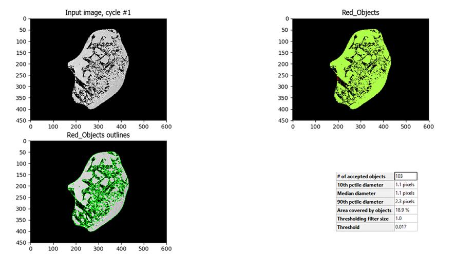 analyzing picrosirius red polarized light images