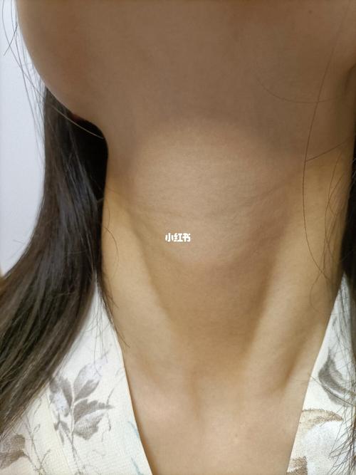 自己的脖子粗,安耐不住各种脑补,吓坏我了,不知道是不是甲状腺肿大,我