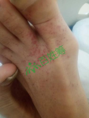 妈妈突发急性白血病 求好心人施于援手 好人一生平安